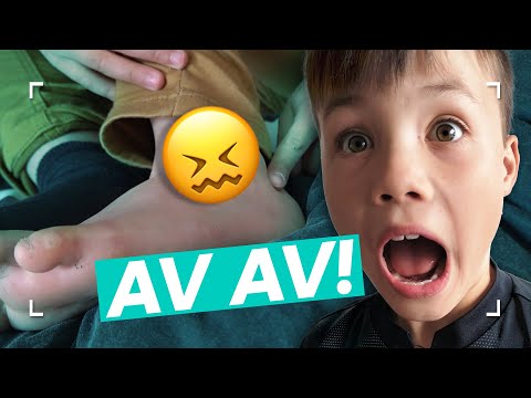 Anton skal opereres i anklen! Bange for at vågne midt i det hele!