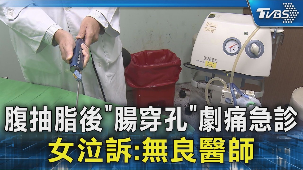 影音/抽脂手術後腸穿孔!59歲婦敗血症休克 家屬控診所稱「病歷丟了」