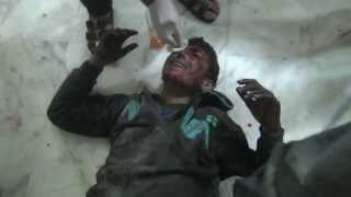 A Dying Boy Cries For His Mother - Syria What foreign plots have done