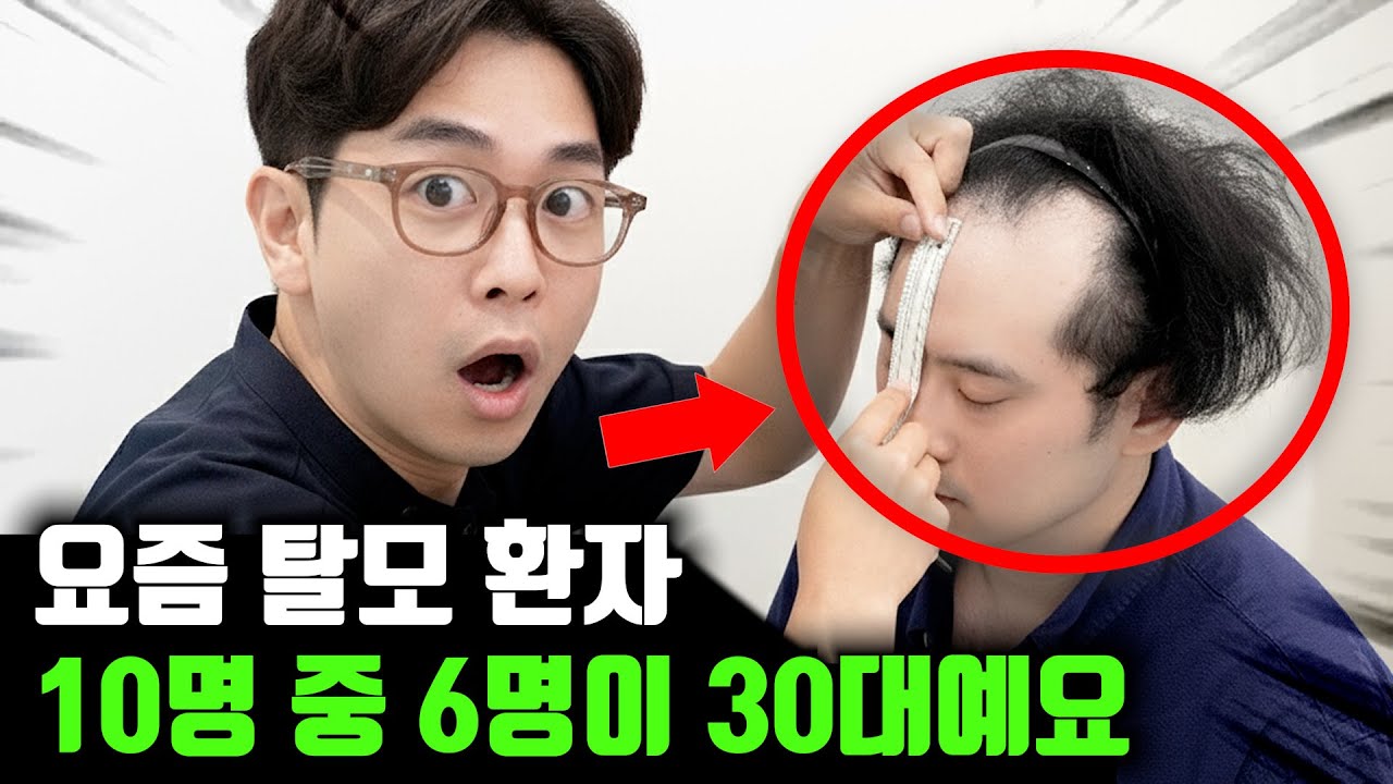 역대급 30대 탈모 ㄷㄷ 새 삶을 시작할 수 있을까?