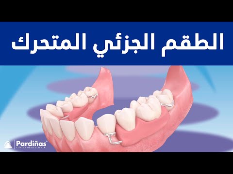 الطقم الجزئي المتحرك ©