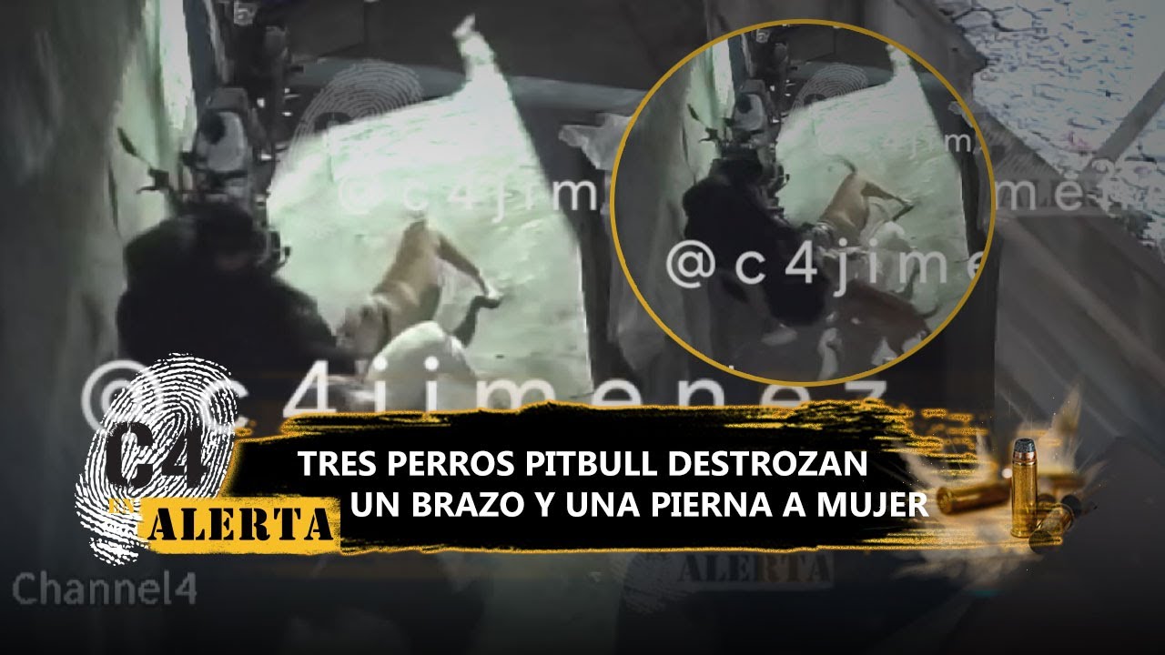 Ana es atacada por 3 perros pitbulls en Tláhuac; le destrozaron un brazo y una pierna