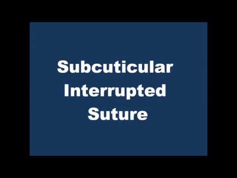 Subcuticular Interrupted Suture [Duke Univ]