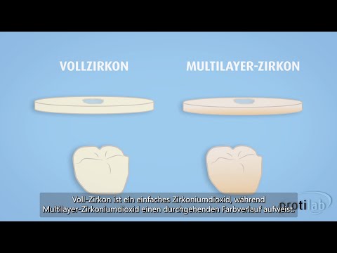 Produktratgeber: Voll-Zirkon / Multilayer-Zirkon