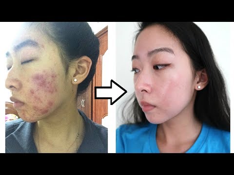 Mawalan ng timbang mabilis na hibla pagkain Luya tea para sa pagbaba ng timbang ng isang mainit o malamig na inumin