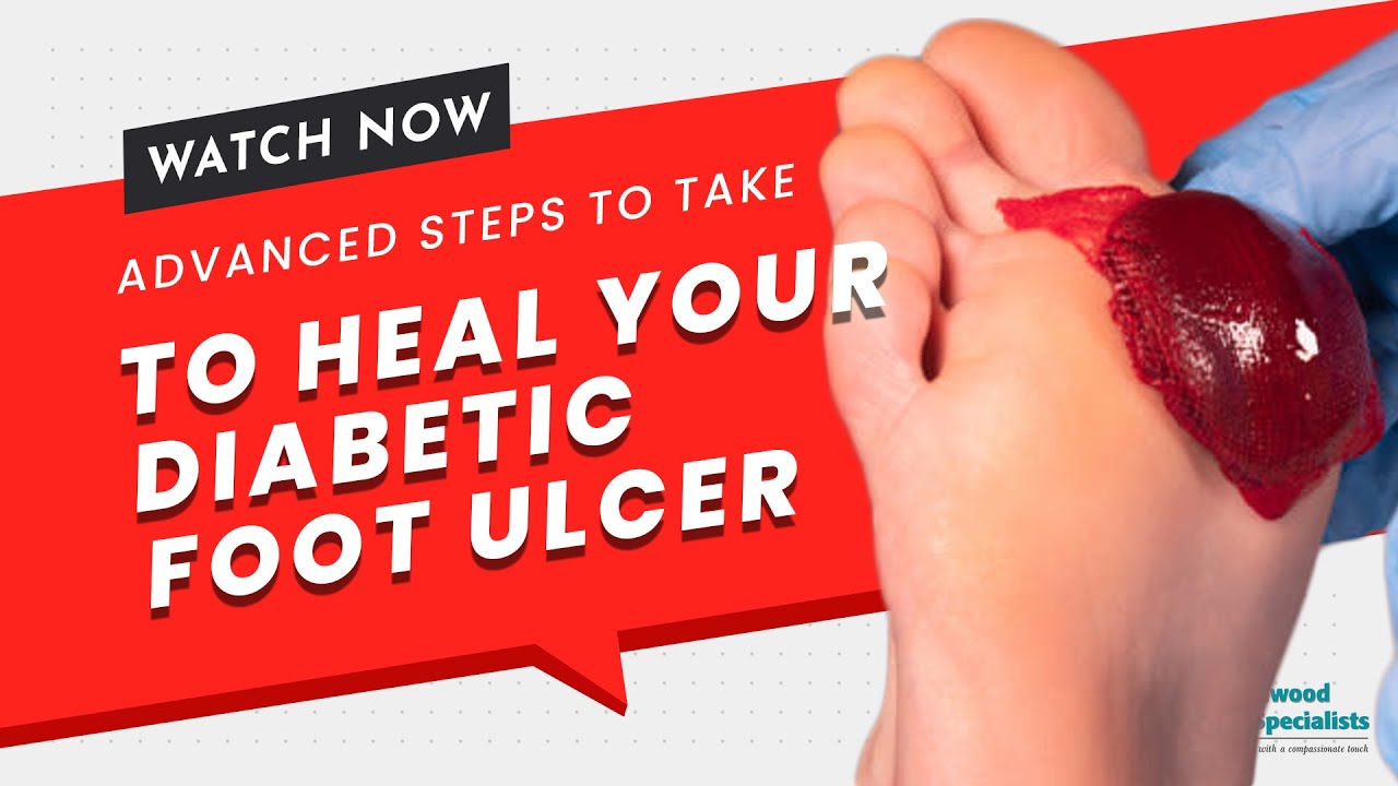 Advanced Steps to Take To Heal Your Diabetic Foot Ulcer
