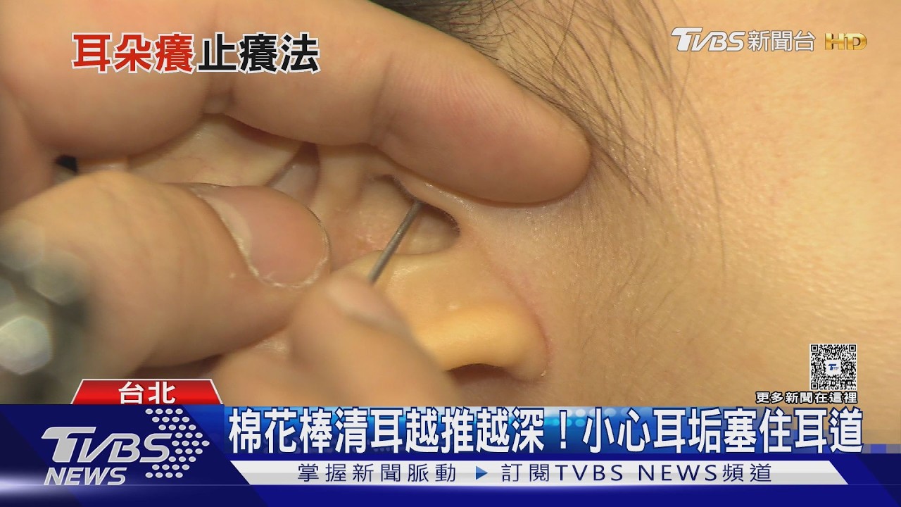 影音／耳朵癢是耳垢太多？醫揭越挖越癢原因、棉花棒清耳風險！