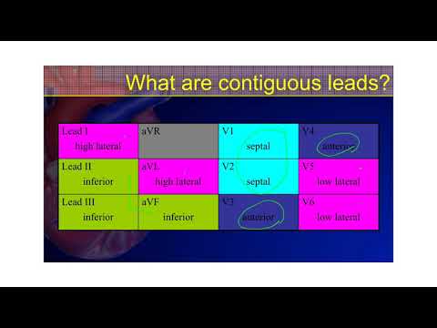 The 12-Lead ECG Course: STE-Mimics Part 1