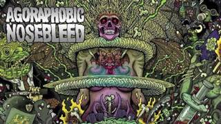 Agoraphobic Nosebleed - Trauma Queen