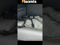 3D Animation Of Placenta Shorts