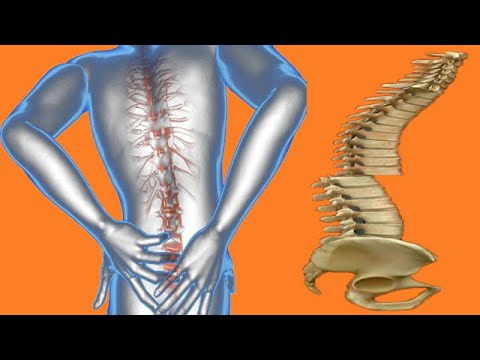 Broken Back: Causes And Symptoms