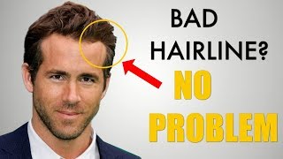 5 Awesome Hairstyles for Widows Peak / Receding Hairline