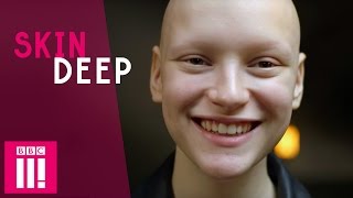 Loving Life Without Hair | Joelle | Skin Deep