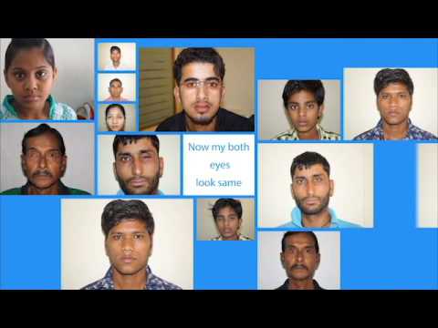 Artificial eye that moves Kolkata India