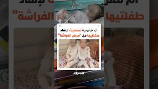 "جلدهما يتلاشى مع كل لمسة".. أم مغربية تكشف مأساة "مرض الفراشة" وتستغيث لإنقاذ ابنتيها thumbnail