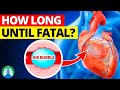 How Long For An Air Embolism To Become Fatal