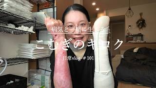 【表皮水疱症】現在やっている治療や身体の状態などの現状まとめ　日常vlog＃101