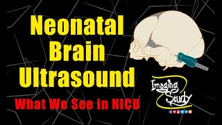 Neonatal Brain Ultrasound || What We See in NICU || Imaging Study Lecture