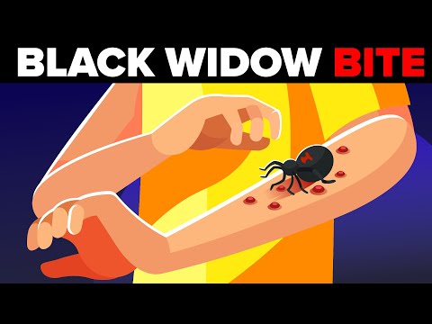 Black Widow Spider Bites - How Painful is it (What Actually Happens to Your Body)?