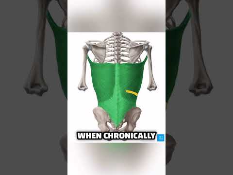 The Truth About Anterior Pelvic Tilt - It’s Not Your Hip Flexors #posture #backpain #lowbackpain