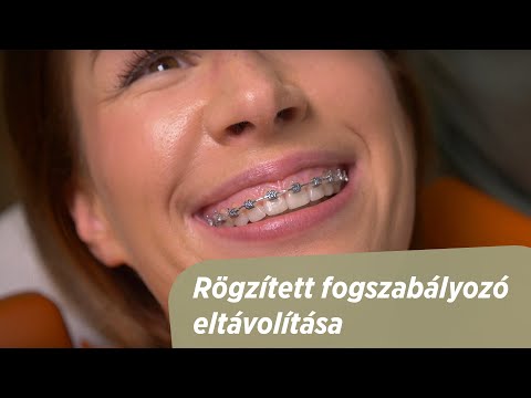 aszcariasis kezelés felnőtteknél