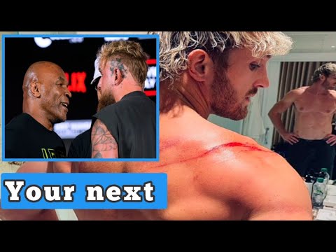 BEATEN!🛑LOGAN PAUL instantly regrets taking the place of brother Jake Paul after brutally beaten up