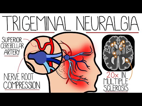 Understanding Wilson s Disease Hepatolenticular Degeneration