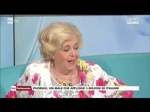 Sintomi di artrite di psoriazny Irradiator quarzo ultravioletto il sole a psoriasi