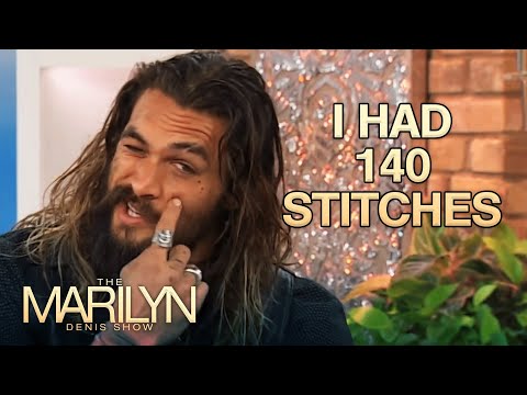 Jason Momoa Scar