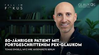 Fall im Fokus: Tomas Engels über einen 80-jährigen Patienten mit fortgeschrittenem PEX-Glaukom