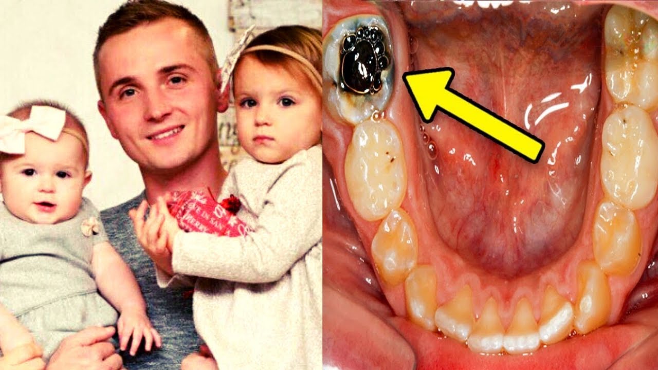 Padre di Famiglia Ignora il Dolore in un Dente e Perde la Vita. Ecco la Spiegazione dei Dentisti