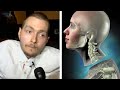 What Happened To The First Human Head Transplant? (Feat. Medlife Crisis)