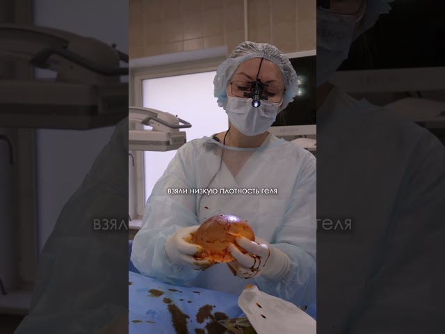 ПЕРВЫЙ КОГЕЗИВ ГРУДНОГО ИМПЛАНТА