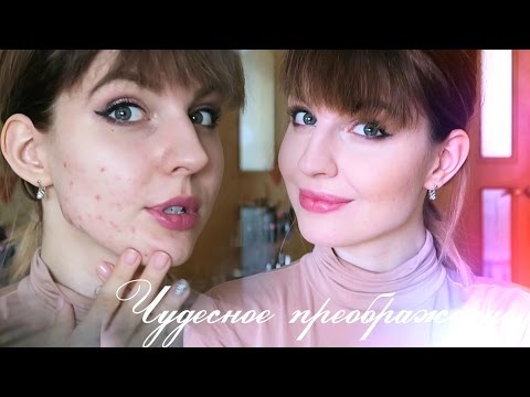 Макияж Для Проблемной Кожи ♥ НЕРЕАЛЬНОЕ Преображение ♥ Ваша Саша♥