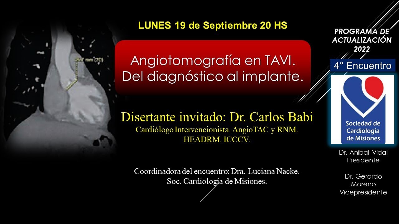 Webinar FAC  - Angiotomografía en TAVI. Del diagnóstico al implante