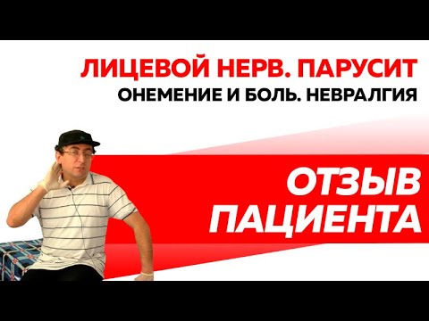 Отзыв Rekinetix. Лицевой нерв. Невралгия. Перекос лица