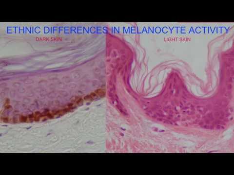 What Is The Decrease In Activity Of Melanocytes Called