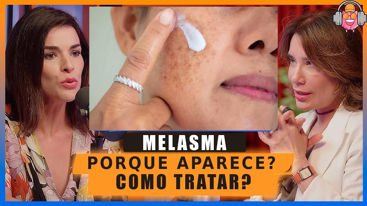A Melhor explicação sobre Mancha no Rosto de MELASMA, como aparece e como tratar?