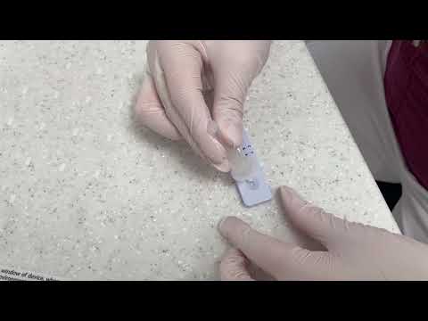 Durchführung Antigen-Test auf Covid19 (Roche°-Schnelltest)