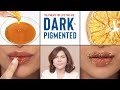 How To Treat DARK, PIGMENTED Lips | Dermatologist's Advice