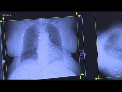 Doctors warn lung damage from COVID-19 may be permanent