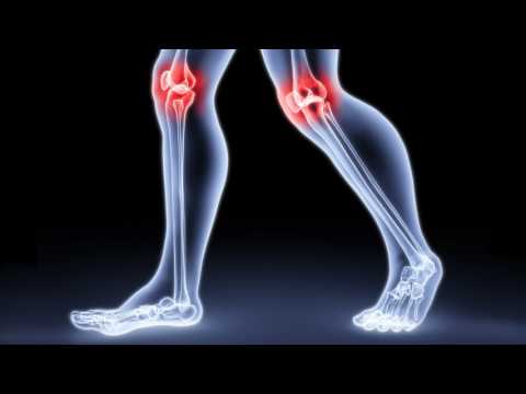 Как лечить растяжение связок колена? Как лечить разрыв связок колена в домашних условиях?