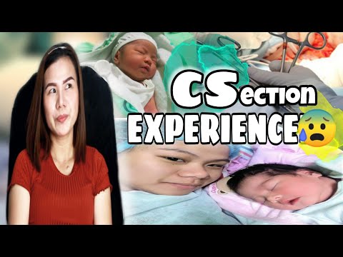 MGA BAGAY NA DAPAT MALAMAN SA PROSESO NG CAESAREAN SECTION (CS) PANGANGANAK || EXPERIENCE KO 😰