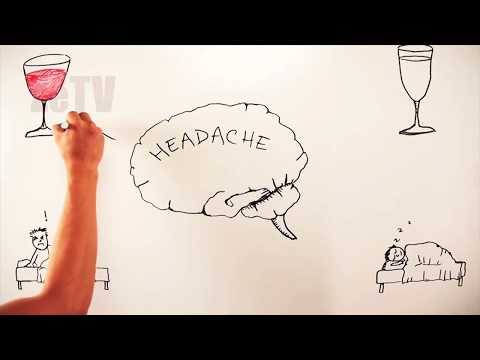 Çfarë është Migrena - "Kuriozitete e këshilla mbi shëndetin"