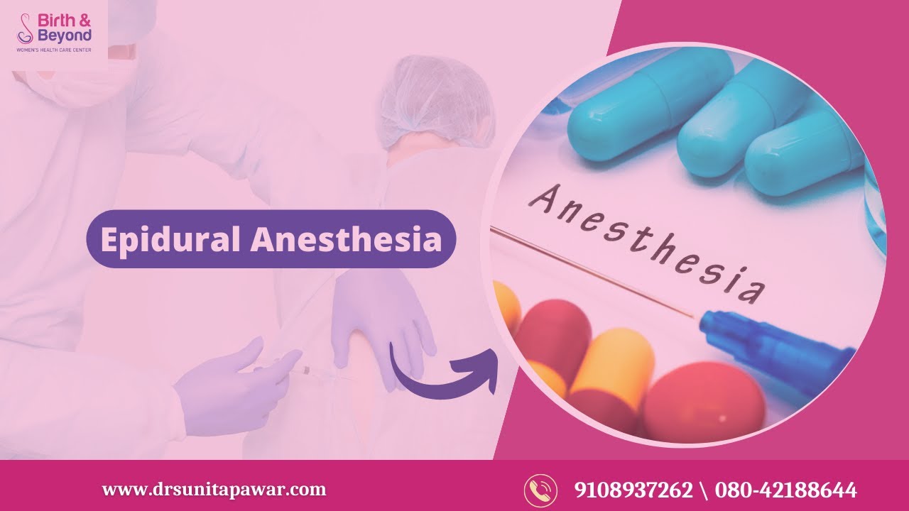 Epidural Anesthesia