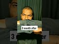 Minoxidil Or Finasteride 3 Month Hair Growth Result AvinashJadhavHairCare Shorts