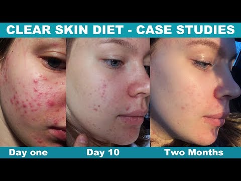 download video viral Cara Diet Gluten, download Cara Diet Gluten gratis, unduh Cara Diet Gluten
