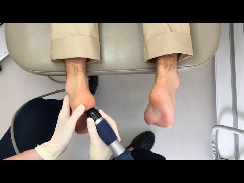Shockwave Therapy Demonstration