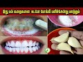 This Will Remove Stains And Make Your Teeth Whiter TEETH WHITENING HOME REMEDY