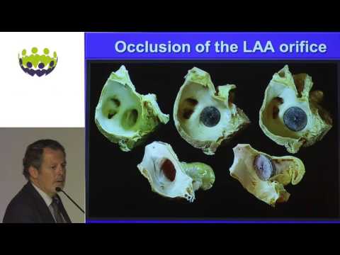 José A. Cabrera - LAA: anatomy & imaging landmarks pertinent to percutaneous transcatheter occlusion